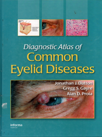 Diagnostic atlas of cammon eyelid diseases